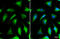 NADH:Ubiquinone Oxidoreductase Core Subunit S3 antibody, GTX105835, GeneTex, Immunocytochemistry image 