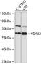 Adrenoceptor Beta 2 antibody, 14-719, ProSci, Western Blot image 