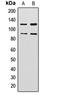 Zinc Finger Protein 148 antibody, orb304670, Biorbyt, Western Blot image 