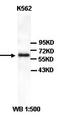 TNF Receptor Superfamily Member 10b antibody, orb77413, Biorbyt, Western Blot image 