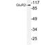 Glutamate Ionotropic Receptor AMPA Type Subunit 2 antibody, LS-C177700, Lifespan Biosciences, Western Blot image 
