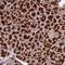 C-Type Lectin Domain Containing 7A antibody, NBP2-13845, Novus Biologicals, Immunohistochemistry frozen image 