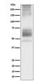Somatostatin Receptor 1 antibody, M04717, Boster Biological Technology, Western Blot image 