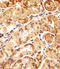 DNA Polymerase Delta Interacting Protein 3 antibody, A02748-1, Boster Biological Technology, Immunohistochemistry paraffin image 