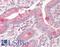 Vesicle Associated Membrane Protein 7 antibody, LS-B8839, Lifespan Biosciences, Immunohistochemistry paraffin image 