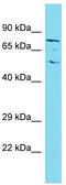 TBC1 Domain Family Member 23 antibody, TA331716, Origene, Western Blot image 