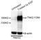 ACK1 antibody, AP0589, ABclonal Technology, Western Blot image 