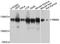 RNA Binding Motif Protein 5 antibody, A10788, ABclonal Technology, Western Blot image 