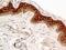 Fibroblast Growth Factor Receptor 1 antibody, NB100-2080, Novus Biologicals, Immunohistochemistry paraffin image 