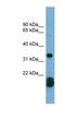 Ras Homolog Family Member F, Filopodia Associated antibody, NBP1-55116, Novus Biologicals, Western Blot image 