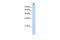 ALOX15B antibody, GTX47100, GeneTex, Western Blot image 