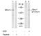 SHC-transforming protein 1 antibody, GTX78947, GeneTex, Western Blot image 