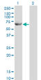 Glycerol kinase 2 antibody, LS-C197301, Lifespan Biosciences, Western Blot image 