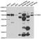 Signal Transducing Adaptor Molecule 2 antibody, STJ29138, St John