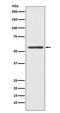 Cytochrome P450 Family 2 Subfamily E Member 1 antibody, M00672, Boster Biological Technology, Western Blot image 