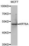 Keratin 6A antibody, LS-C349318, Lifespan Biosciences, Western Blot image 