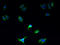 Secretory carrier-associated membrane protein 5 antibody, A60786-100, Epigentek, Immunofluorescence image 
