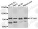 Eukaryotic Translation Initiation Factor 2 Alpha Kinase 1 antibody, A3415, ABclonal Technology, Western Blot image 