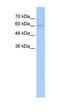 Transforming Growth Factor Beta Receptor 2 antibody, orb333717, Biorbyt, Western Blot image 