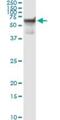 Serine/Threonine Kinase 33 antibody, H00065975-M09, Novus Biologicals, Immunoprecipitation image 