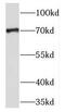 Transmembrane 9 Superfamily Member 4 antibody, FNab08733, FineTest, Western Blot image 
