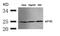 Eukaryotic Translation Initiation Factor 4E antibody, 79-374, ProSci, Western Blot image 