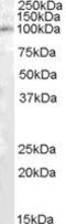 Peptidylglycine Alpha-Amidating Monooxygenase antibody, MBS421605, MyBioSource, Western Blot image 