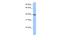 MLLT3 Super Elongation Complex Subunit antibody, A03367, Boster Biological Technology, Western Blot image 