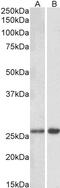 Galectin 3 antibody, 42-452, ProSci, Enzyme Linked Immunosorbent Assay image 