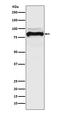 Transforming Growth Factor Beta Receptor 2 antibody, M00759, Boster Biological Technology, Western Blot image 