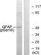 GFAP antibody, OAAF07655, Aviva Systems Biology, Western Blot image 
