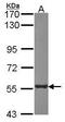 Proteasome 26S Subunit, Non-ATPase 5 antibody, PA5-30137, Invitrogen Antibodies, Western Blot image 