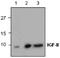 Insulin Like Growth Factor 2 antibody, GTX59760, GeneTex, Western Blot image 