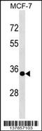 Epithelial Stromal Interaction 1 antibody, 59-262, ProSci, Western Blot image 