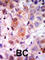 G Protein-Coupled Receptor Kinase 2 antibody, abx033109, Abbexa, Western Blot image 