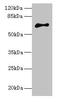 Armadillo Repeat Containing X-Linked 2 antibody, CSB-PA755485LA01HU, Cusabio, Western Blot image 