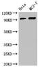 Tetratricopeptide Repeat Domain 27 antibody, CSB-PA757569LA01HU, Cusabio, Western Blot image 