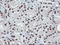Exosome Component 7 antibody, LS-C173714, Lifespan Biosciences, Immunohistochemistry frozen image 
