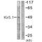 Inward rectifier potassium channel 16 antibody, MBS9413658, MyBioSource, Western Blot image 