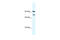 Zinc Finger E-Box Binding Homeobox 2 antibody, 27-923, ProSci, Enzyme Linked Immunosorbent Assay image 