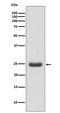 Thymidine Kinase 1 antibody, M04850, Boster Biological Technology, Western Blot image 