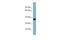 Acyl-CoA Synthetase Medium Chain Family Member 2A antibody, PA5-69382, Invitrogen Antibodies, Western Blot image 