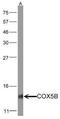 Cytochrome C Oxidase Subunit 5B antibody, NBP1-31303, Novus Biologicals, Western Blot image 