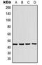 Purinergic Receptor P2X 1 antibody, MBS821241, MyBioSource, Western Blot image 