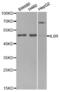 Interleukin 6 Receptor antibody, abx001321, Abbexa, Western Blot image 