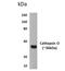 Cathepsin K antibody, NBP2-12083, Novus Biologicals, Western Blot image 