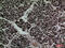 CD2 Molecule antibody, A00570, Boster Biological Technology, Immunohistochemistry paraffin image 