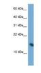 Poly(A) Binding Protein Interacting Protein 2 antibody, NBP1-79620, Novus Biologicals, Western Blot image 