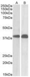 SET Nuclear Proto-Oncogene antibody, NB100-817, Novus Biologicals, Western Blot image 