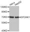 Eukaryotic Translation Initiation Factor 2 Alpha Kinase 1 antibody, abx002449, Abbexa, Western Blot image 